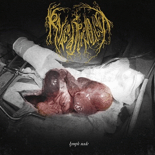 Ravaged Spleen Outburst : Lymph Node Ravaged Spleen Outburst : Lymph Node